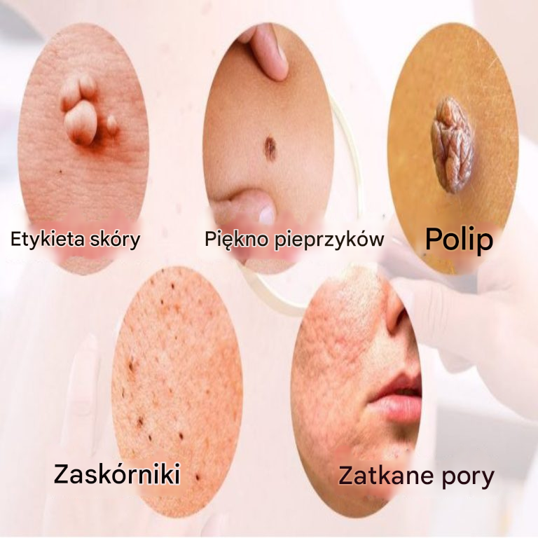 8 poważnych chorób, o których informuje nas nasza skóra