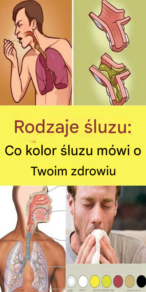 Rodzaje śluzu: Co kolor śluzu mówi o Twoim zdrowiu