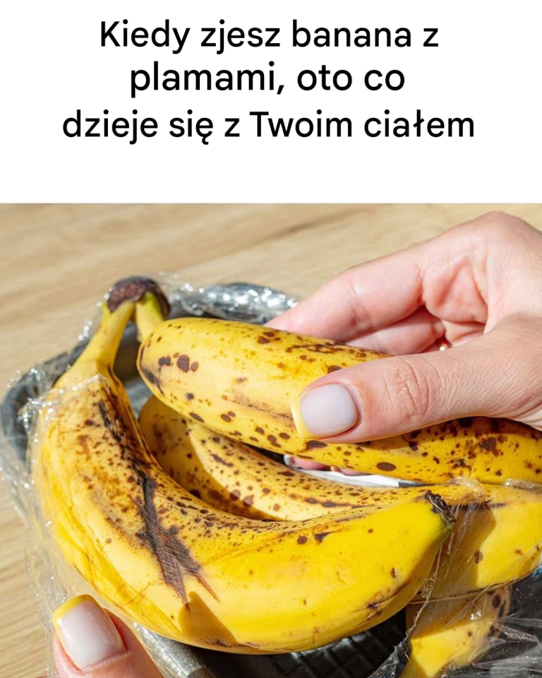 Kiedy zjesz banana z plamami, oto co dzieje się z Twoim ciałem