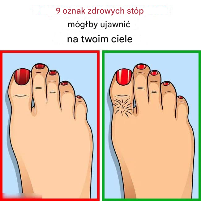 9 oznak zdrowia, które Twoje stopy mogą ujawniać na temat Twojego ciała