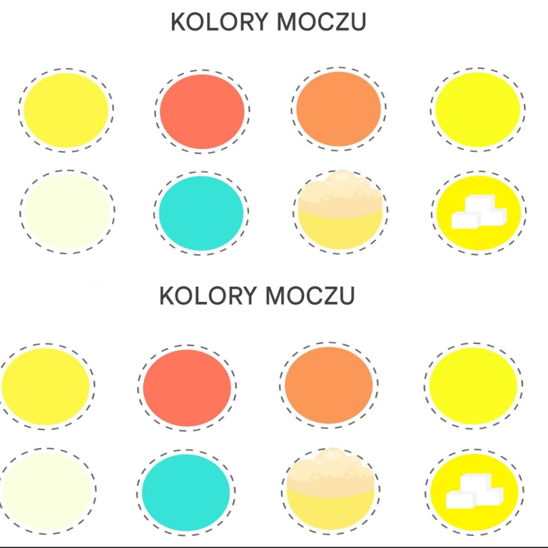 Kolor moczu może ujawnić wszystko na temat Twojego zdrowia! (Pilnie zapoznaj się z tą listą!)