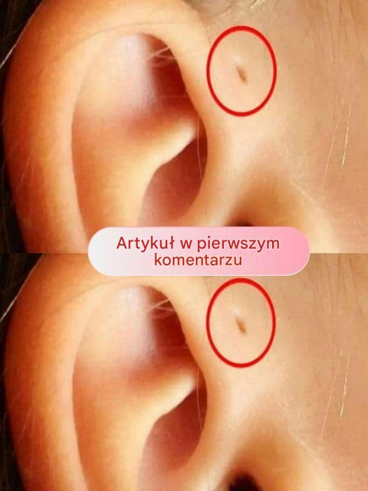 Skąd się biorą otwory nad uszami?