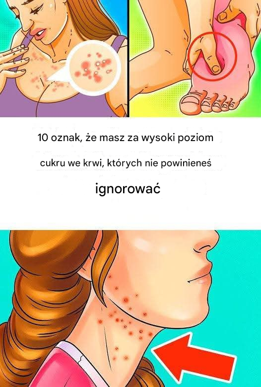 10 oznak, że jesz za dużo cukru