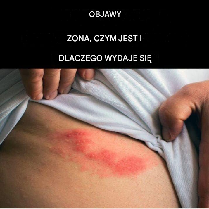 OBJAWY PÓŁPASIECI, CO TO JEST I DLACZEGO SIĘ POJAWIA