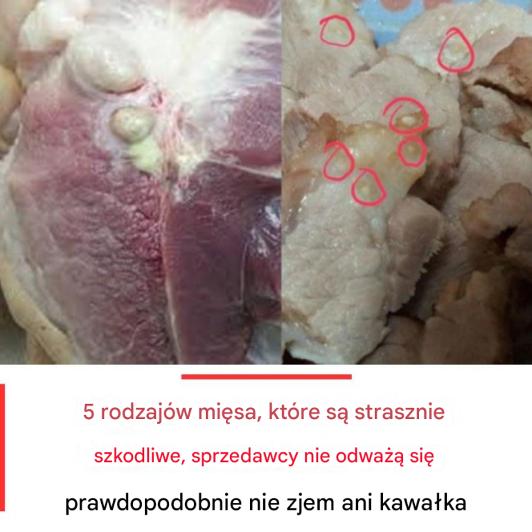 5 rodzajów mięsa, które są strasznie szkodliwe