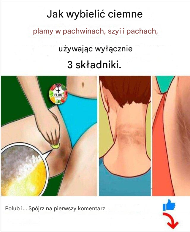 Jak usunąć ciemne plamy w wrażliwych miejscach ciała