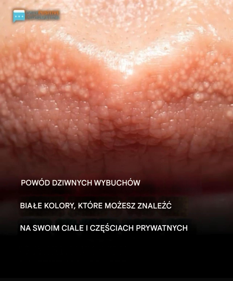 Przyczyna dziwnych białych pryszczy na ciele