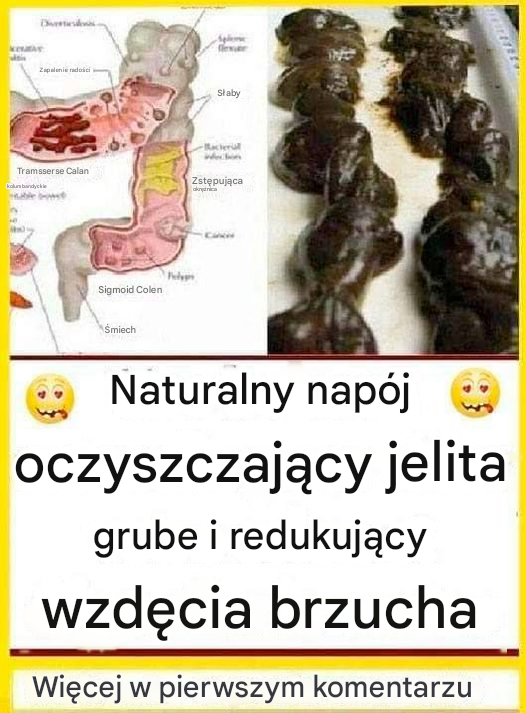 Dowiedz się, jak oczyścić 15 kilogramów odpadów z jelita grubego w nocy