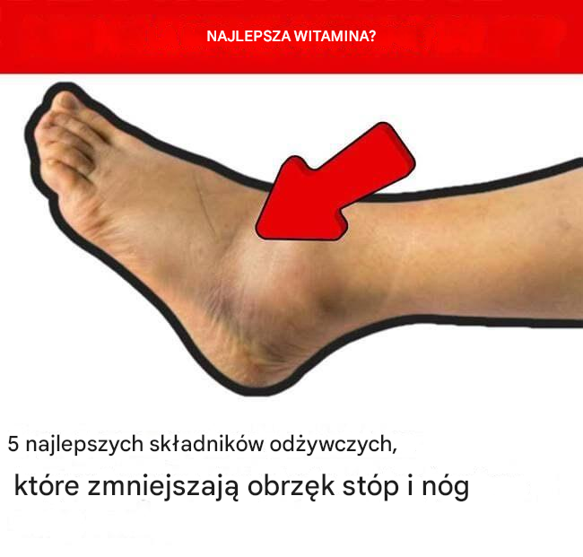 5 najlepszych składników odżywczych, które zmniejszają obrzęk stóp i nóg