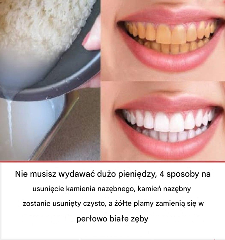 Jak dbać o zęby i oszczędzać pieniądze na wizytach u dentysty – domowe sposoby na zdrowy uśmiech