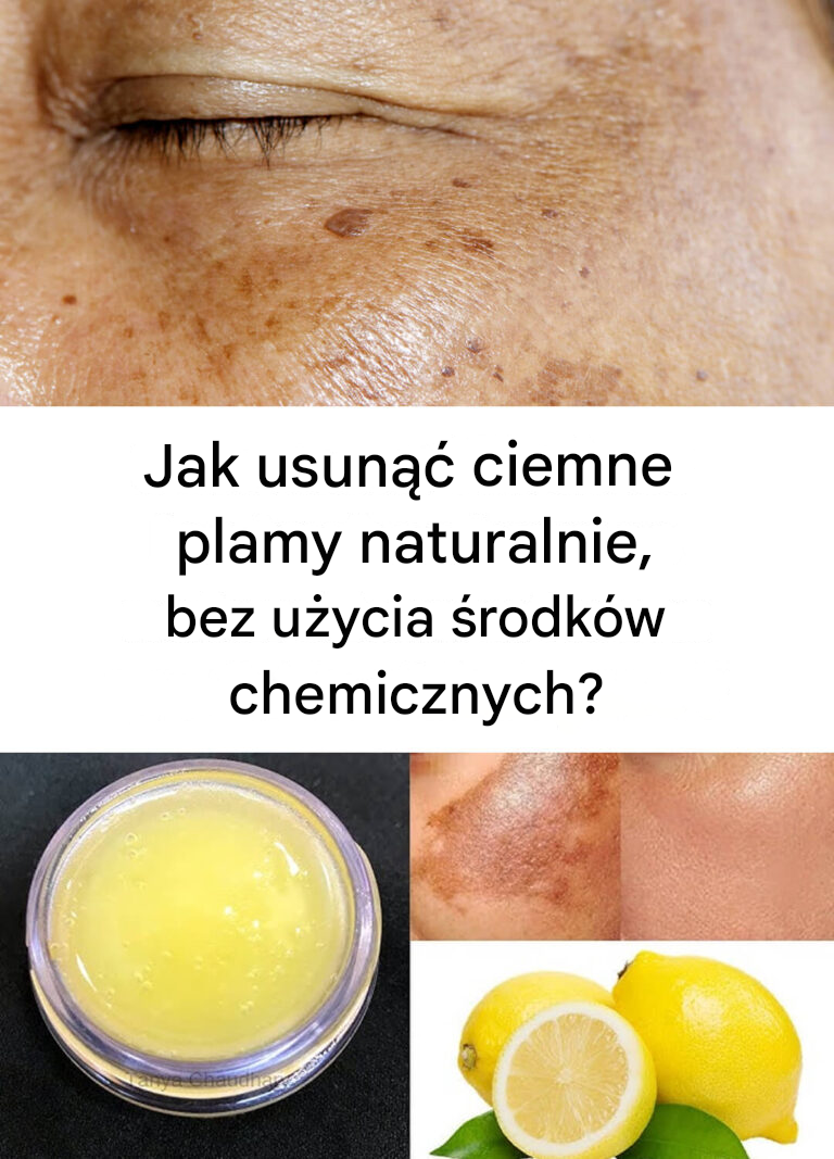Jak pozbyć się ciemnych plam przy pomocy naturalnych środków?