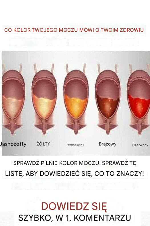 Kolor moczu może ujawnić wszystko na temat Twojego zdrowia! (Pilnie zapoznaj się z tą listą!)