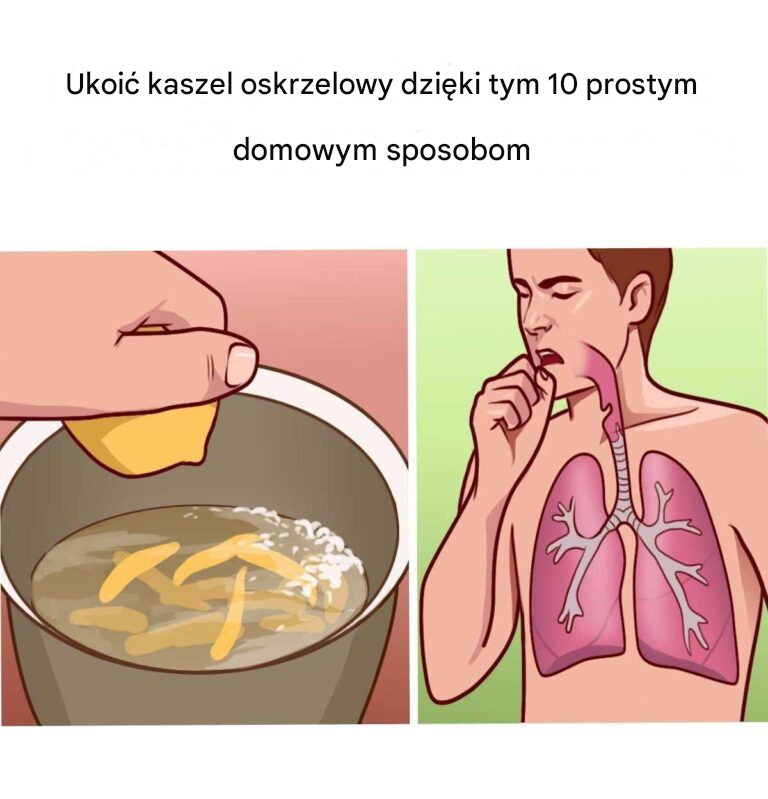 10 naturalnych środków na zapalenie oskrzeli, które zatrzymają bolesne ataki kaszlu