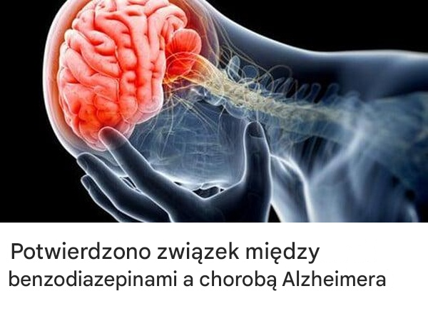 Potwierdzono związek między benzodiazepinami a chorobą Alzheimera