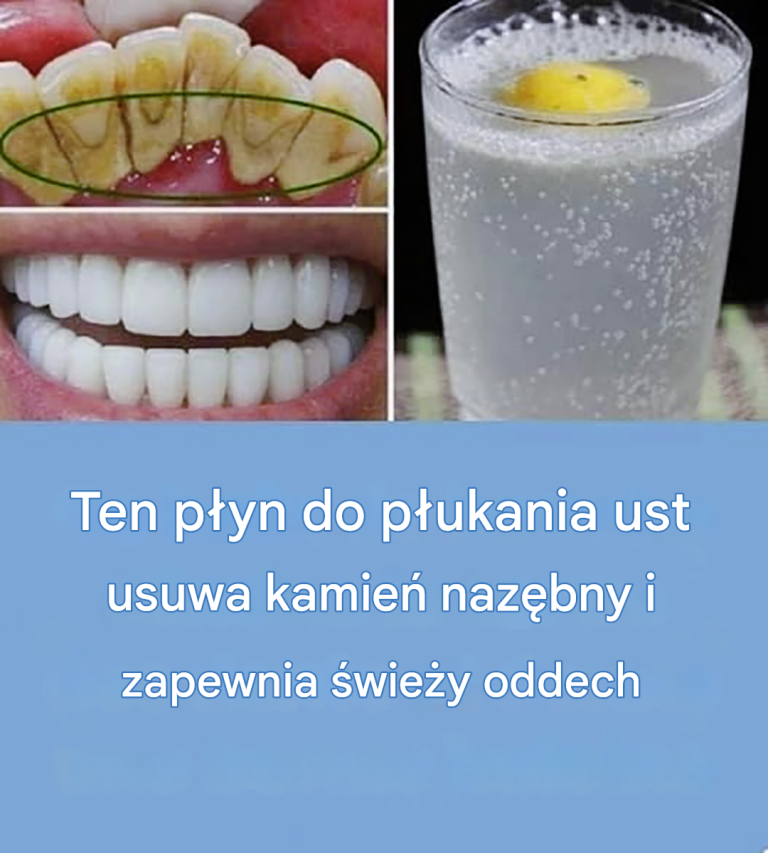 Ten płyn do płukania jamy ustnej naturalnie usuwa kamień nazębny